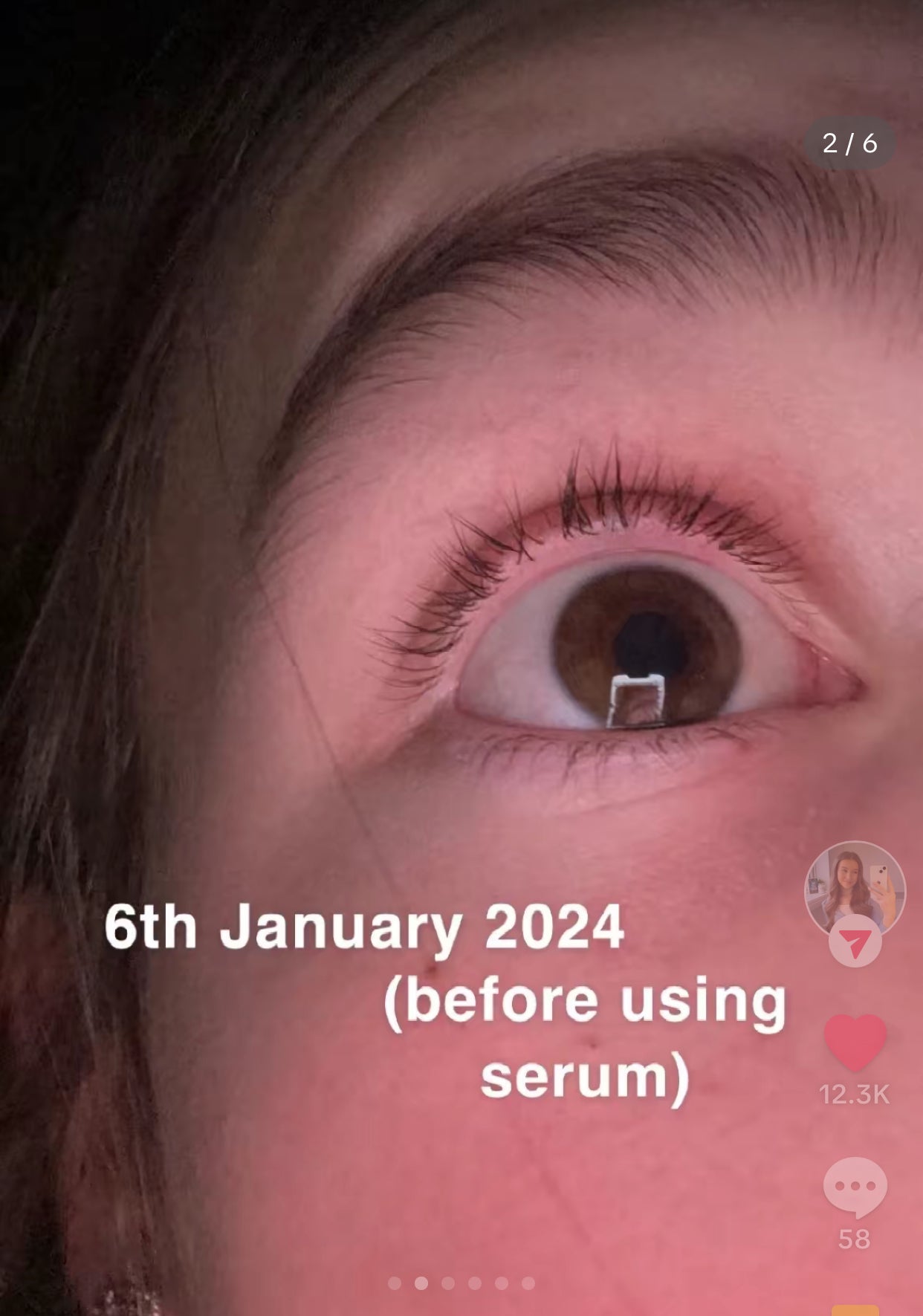 Eyelash Growth Serum